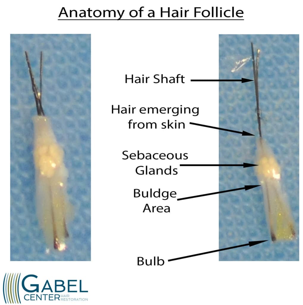 hair follicle under microscope