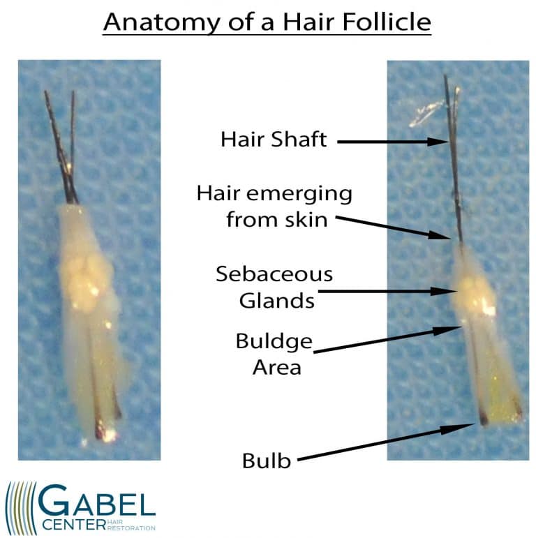 the-hair-follicle-anatomy-gabel-center