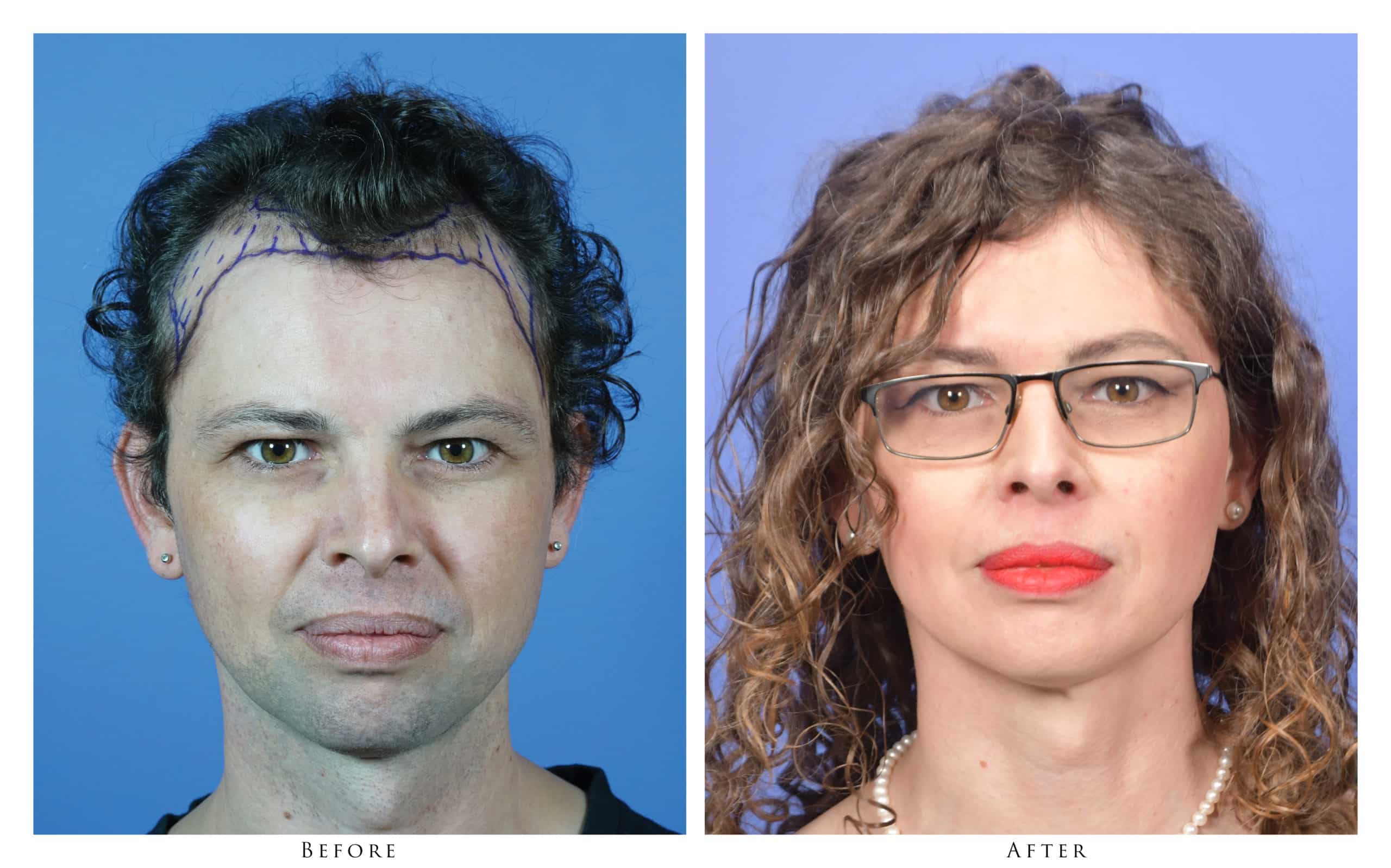 male to female transition before and after photos